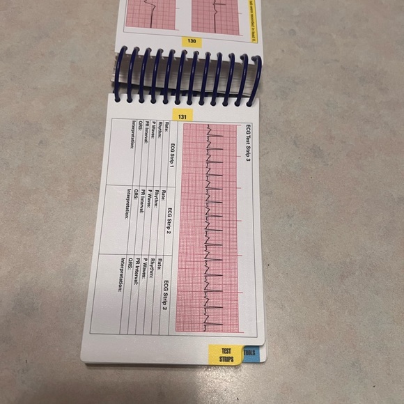 ECG interpretation & management guide. Provides the basics to ACLS - Picture 8 of 16
